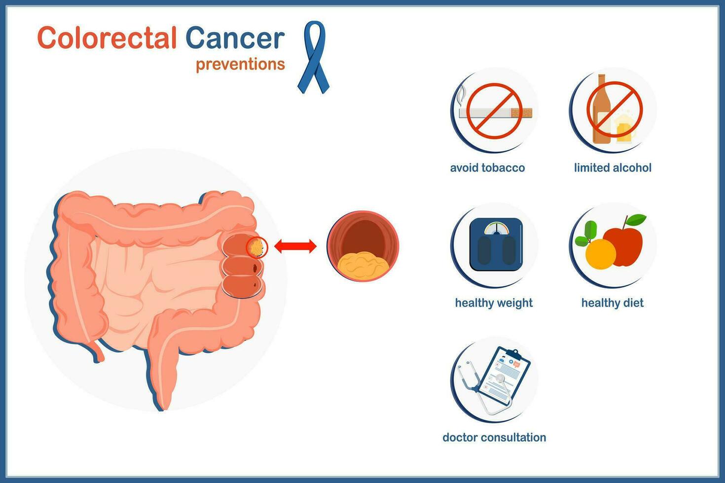 Medical vector illustration concept.Human colorectal cancer.Colorectal cancer preventions.avoid tobacco,limited alcohol,healthy weight,healthy diet and doctor consultation.isolated on white background