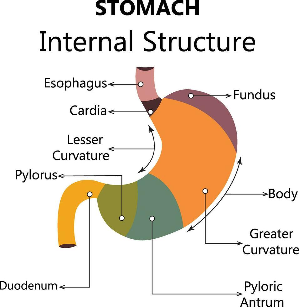 Gastroesophageal reflux disease stomach with main parts labeled. Medical vector illustration with the shape of a sick human body, fragments of healthy and sick stomach isolated on a white background