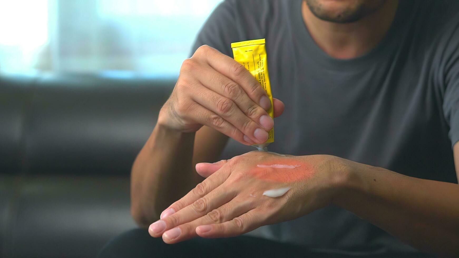 Close up hand of asian man applying gel pain reliever. massages hand hurts using laptop for long period of time. office injury syndrome consept. photo