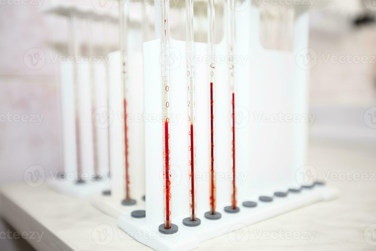prueba tubos con sangre en un médico bioquímico laboratorio. foto