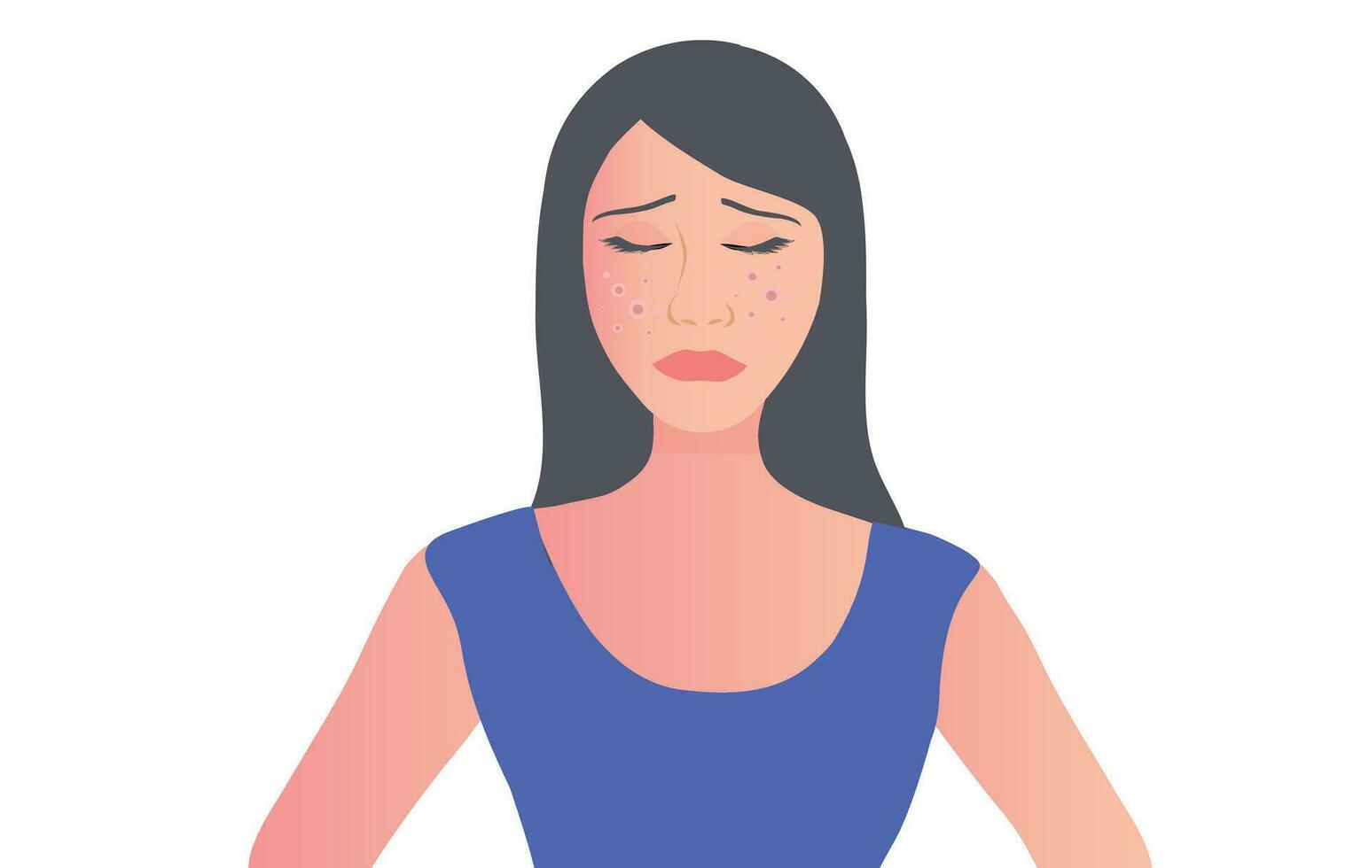 Young woman face with skin acne, pimples, blackheads vector illustration. Acne skin face problem concept