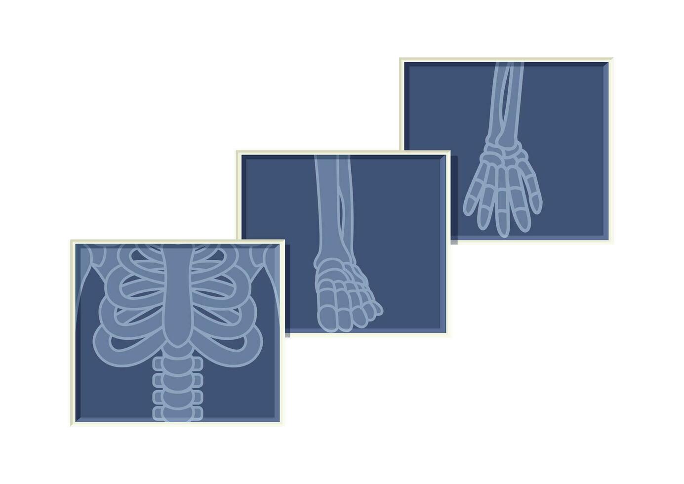 pecho, brazo y pie esqueleto huesos X rayo radiología vector plano diseño en blanco antecedentes