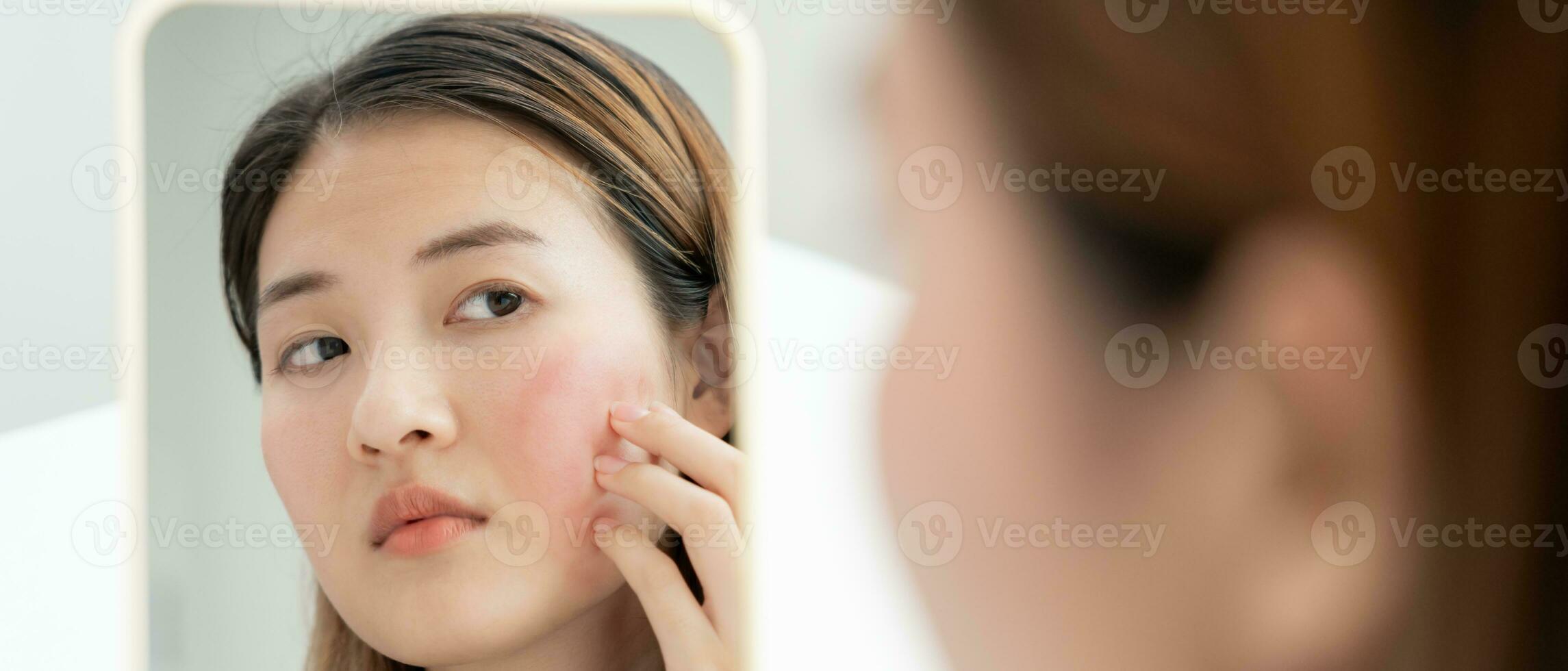 Young woman asian are worried about faces Dermatology and allergic to steroids in cosmetics. sensitive skin, red face from sunburn, acne, allergic to chemicals, rash on face. skin problems and beauty photo