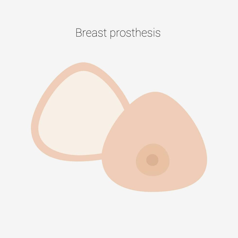 pecho prótesis. pecho prótesis para pecho cáncer paciente después mastectomía. vector ilustración.