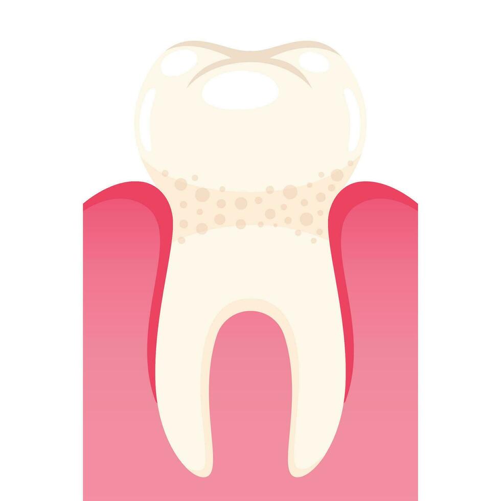 Vector strong tooth in gum on white background