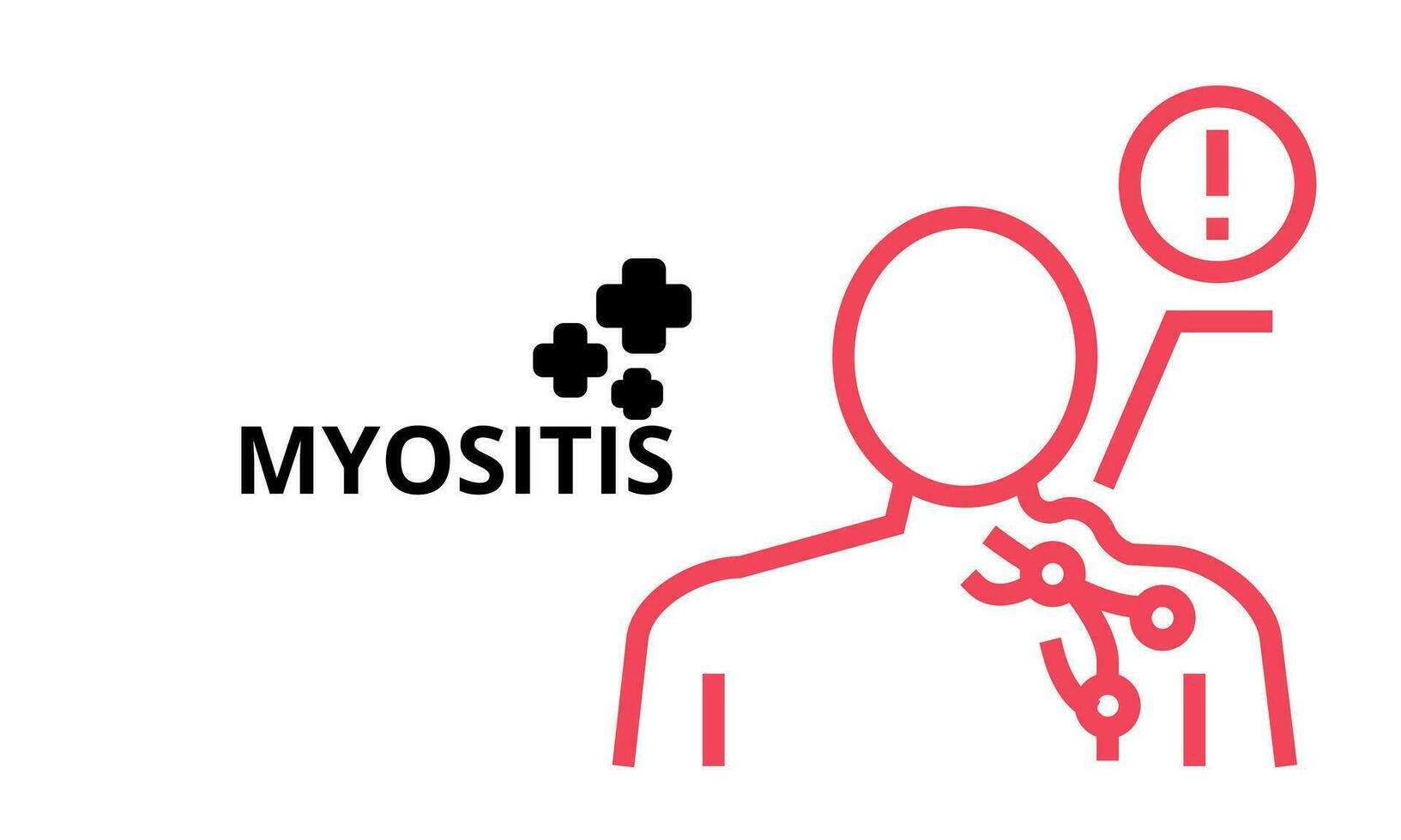 Myositis vector illustration for medical icon 29333435 Vector Art at Vecteezy