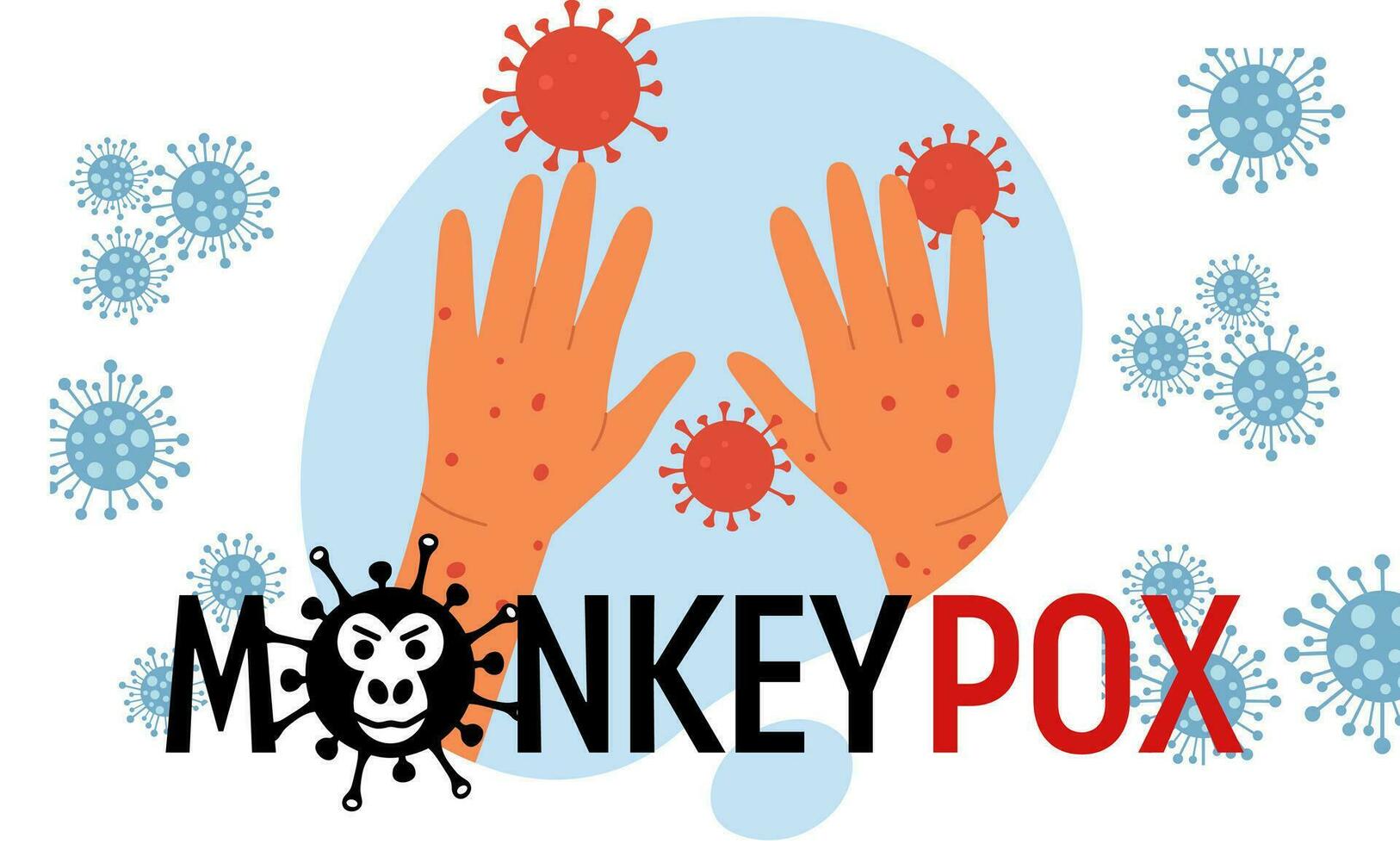 Monkeypox virus banner virus outbreak pandemic design with microscopic view background. Vector illustration