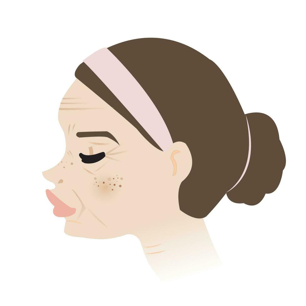 Woman face with aging skin side view vector isolated on white background. Aged skin contains several signs of degeneration, wrinkles, sagging, melasma, blemish, freckle, dark spots.