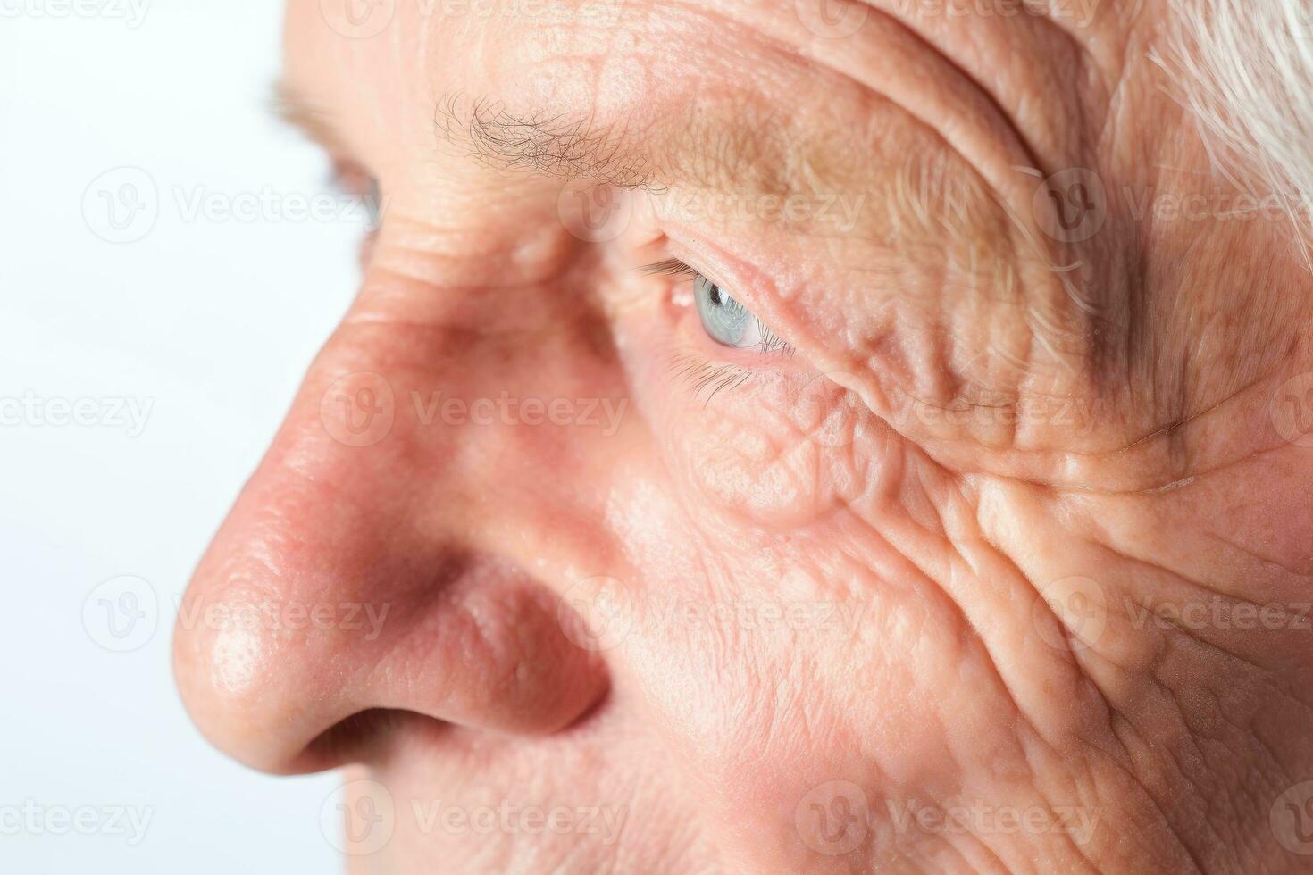 Skin diseases-allergies, psoriasis, eczema, dermatitis, Symptoms of health issues and disease,Generative AI illustration photo