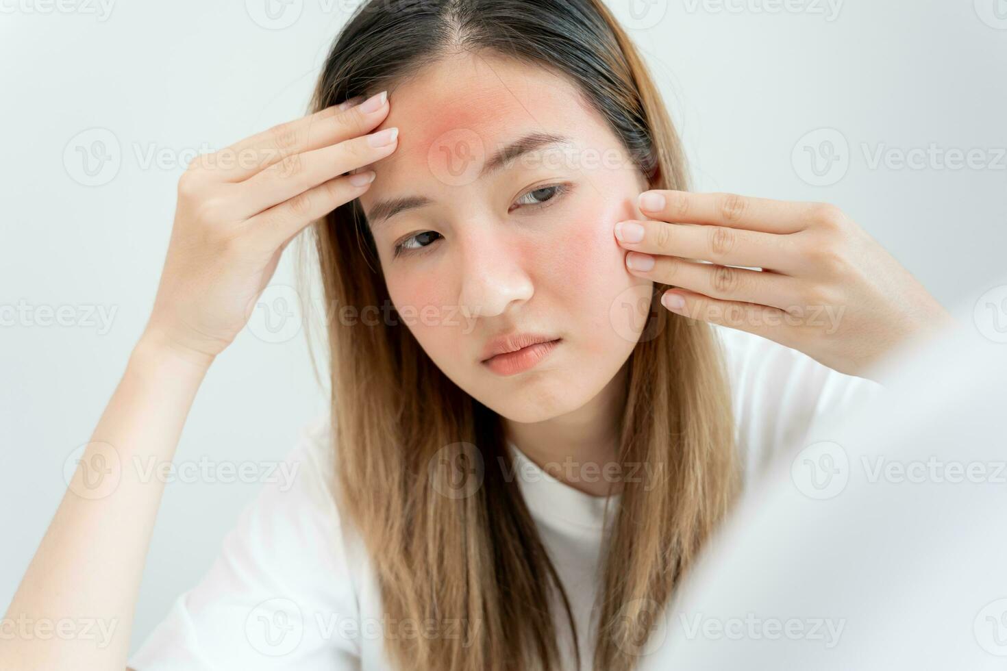 Young woman asian are worried about faces Dermatology and allergic to