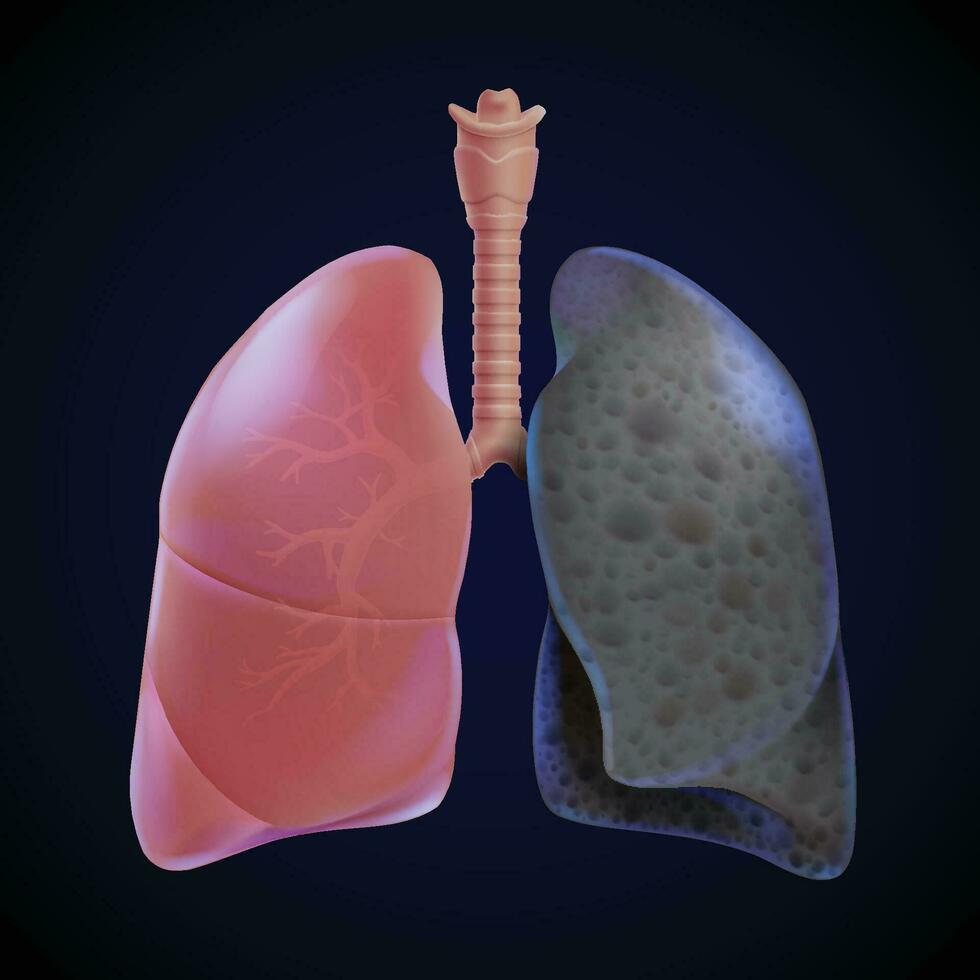 3D illustration of healthy human lungs and smoking lung, lung cancer on a blue-black background. Front view of human lungs before and after smoking. vector
