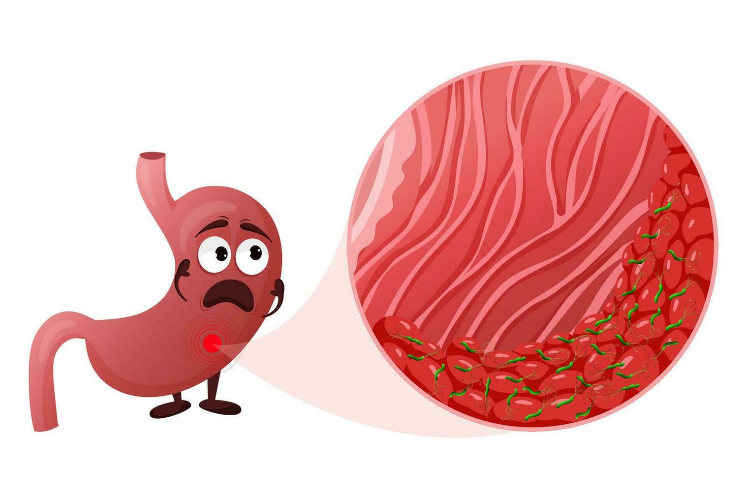 Cartoon stomach character with helicobacter pylori infection in mucosa layer under magnification vector