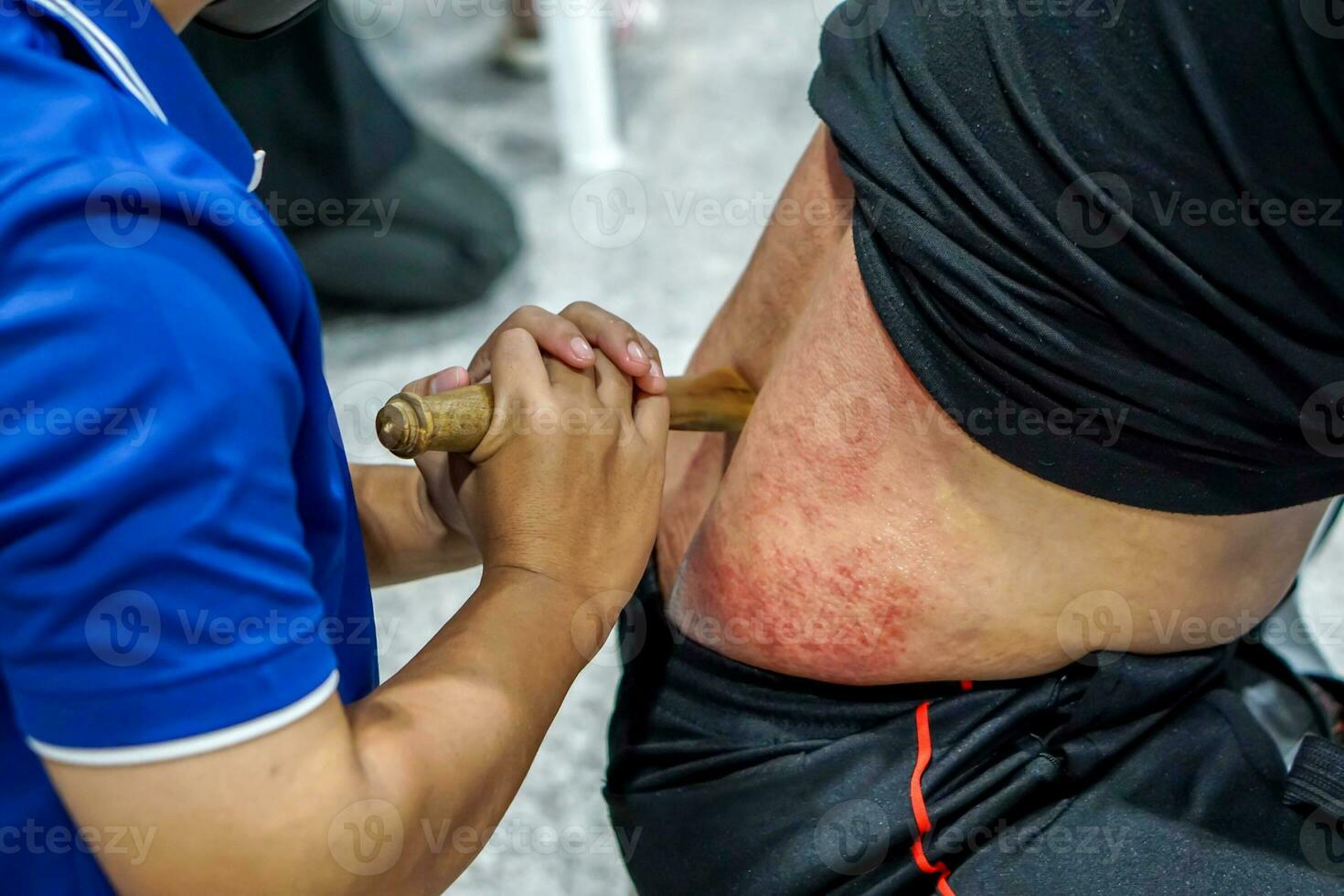 Closeup and crop Thai northern ancient medical massage with oil and use a acupressure stick to treat toxins in the body. photo