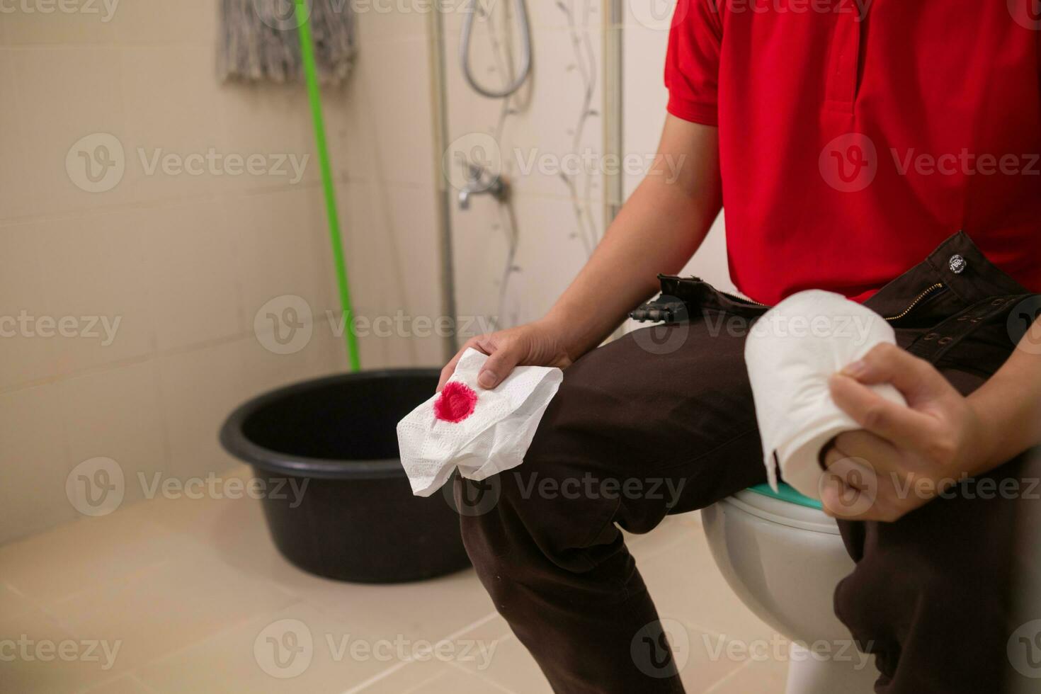 man has hemorrhoids that have worsened and enlarged, and hemorrhoids are severely inflamed, causing bleeding when defecation, infection, weakness and fainting. Inflammatory hemorrhoids pain concept photo