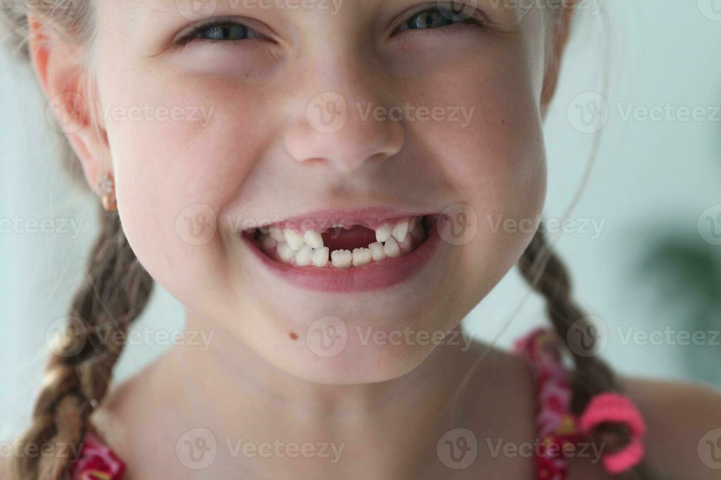de cerca sonrisa de un muchacha. un hermosa pequeño niña 6-7 años antiguo tiene perdido Leche dientes. pérdida de Leche dientes, reemplazo de permanente dientes. foto
