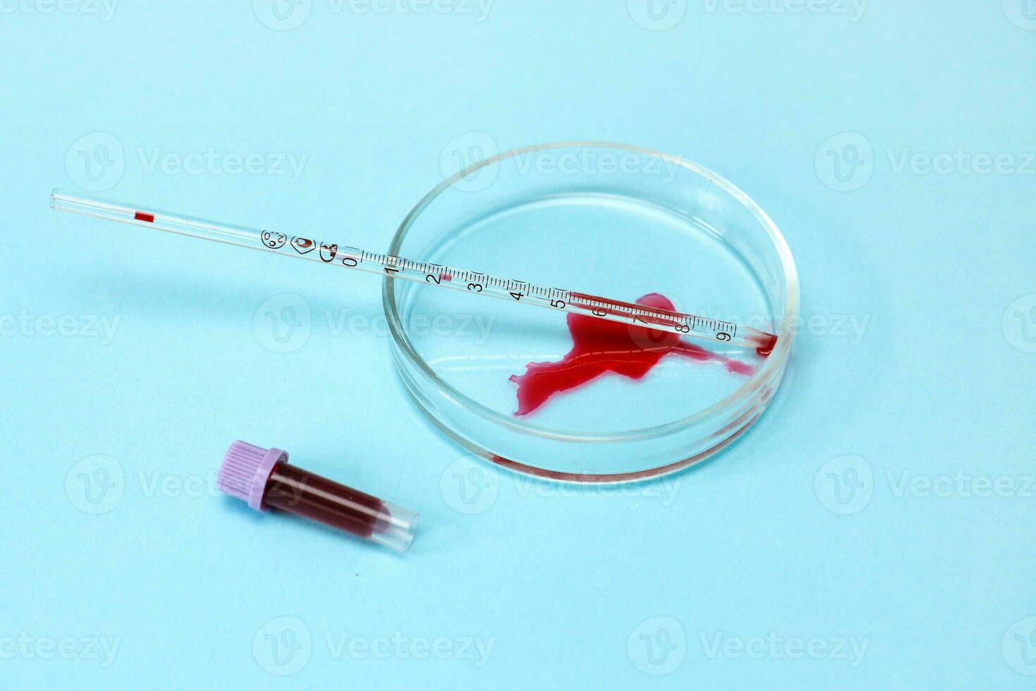 Petri dish with blood stain in the form of a heart, test tube, with blood photo