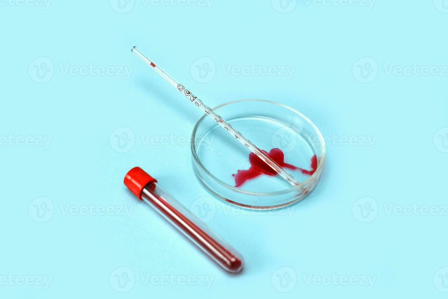 Petri dish with blood stain in the form of a heart, test tube, with blood photo