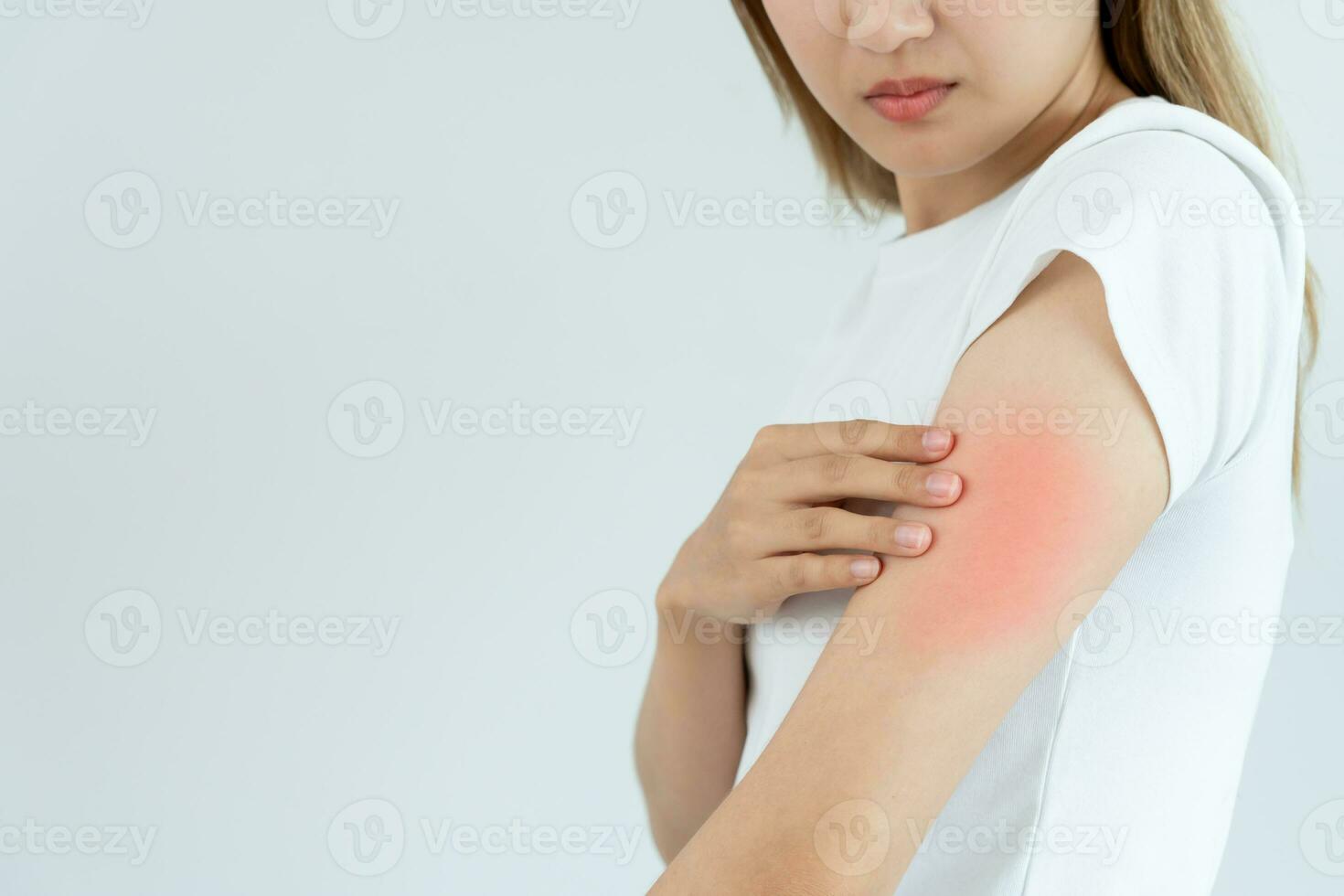 skin problem and beauty. Young woman scratch body has itchy skin from skin allergic, steroid allergy, sensitive skin, red from sunburn, chemical allergy, rash, insect bites, Seborrheic Dermatitis. photo