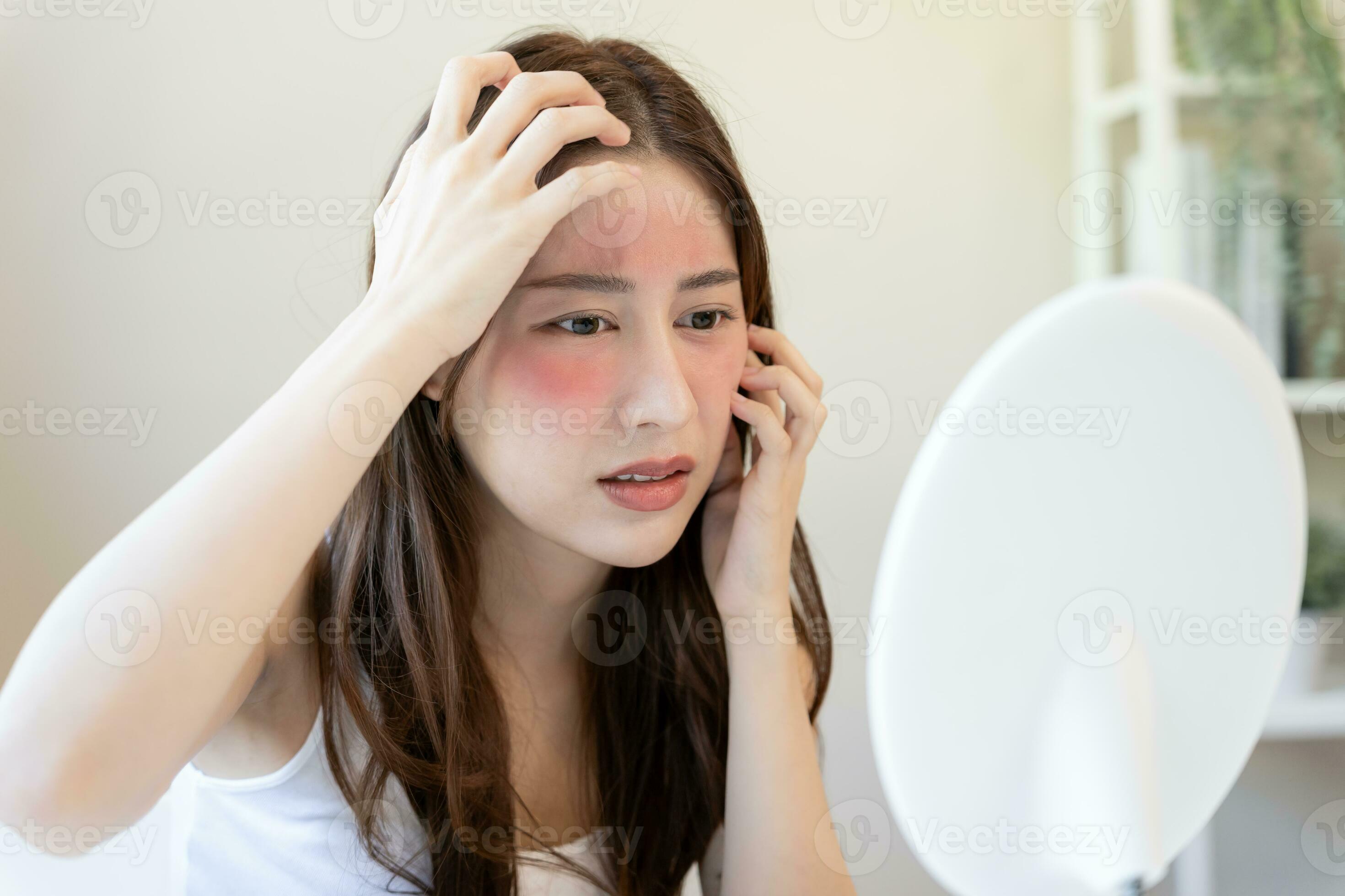 Woman worried about face Dermatology, rosacea dermatitis, allergic