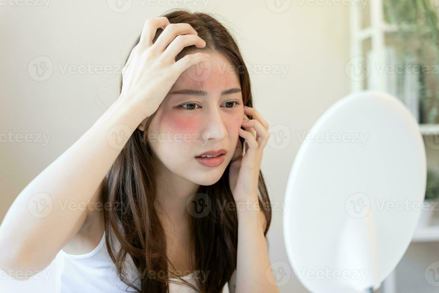 Woman worried about face Dermatology, rosacea dermatitis, allergic steroids, sensitive skin, red face from sunburn, acne, dry skin, large pores ,rash face, dull, freckles, wrinkle, skin problem photo