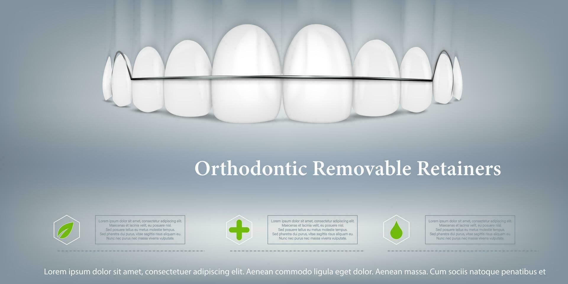 Ilustración vectorial 3d, dientes realistas con frenos en la mandíbula superior e inferior. alineación de la mordida de los dientes, dentición con frenos, frenos dentales. vector