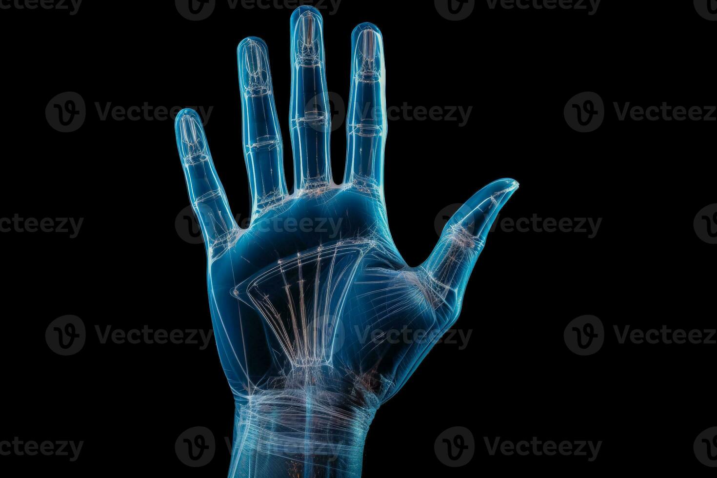 Clear X ray image illustrating a human hand joint and bone structure photo