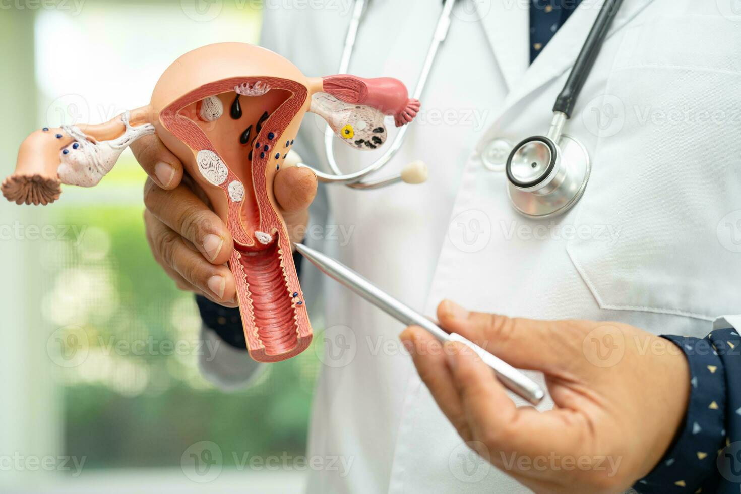 Uterus, doctor holding anatomy model for study diagnosis and treatment in hospital. photo