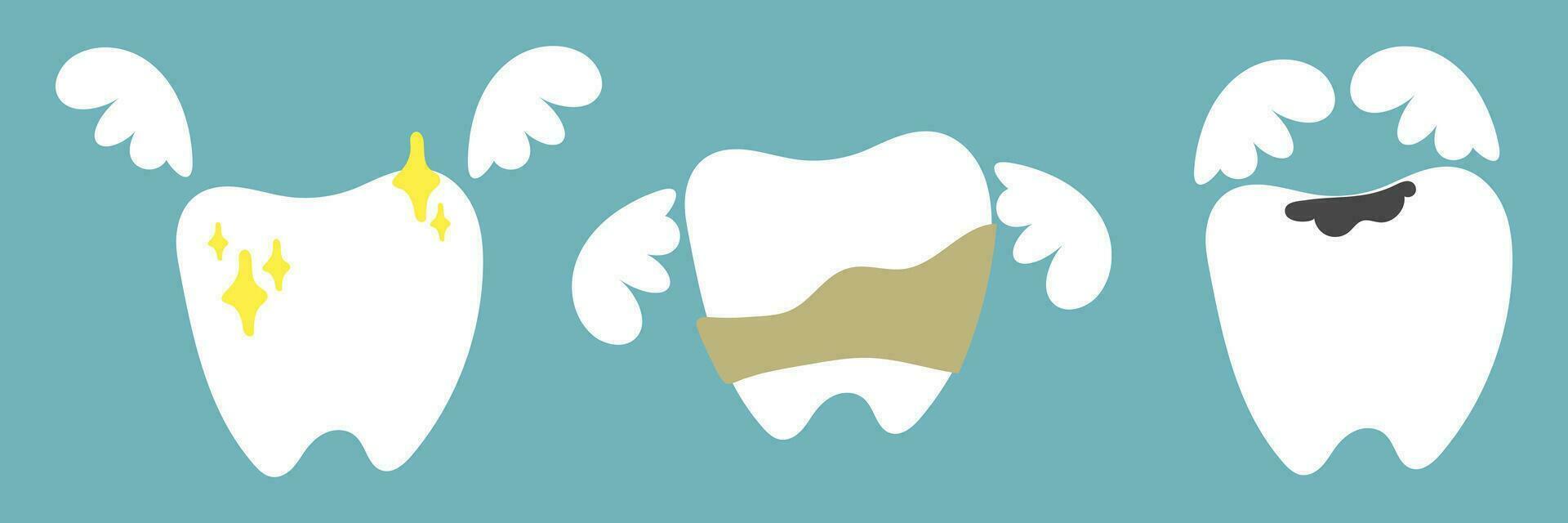 A set of teeth with problems and wings. A clean tooth with shine, a tooth with caries, a tooth with tartar. Dental problems, treatment. Wings with emotions of joy, fear, sadness. Isolated flat vector