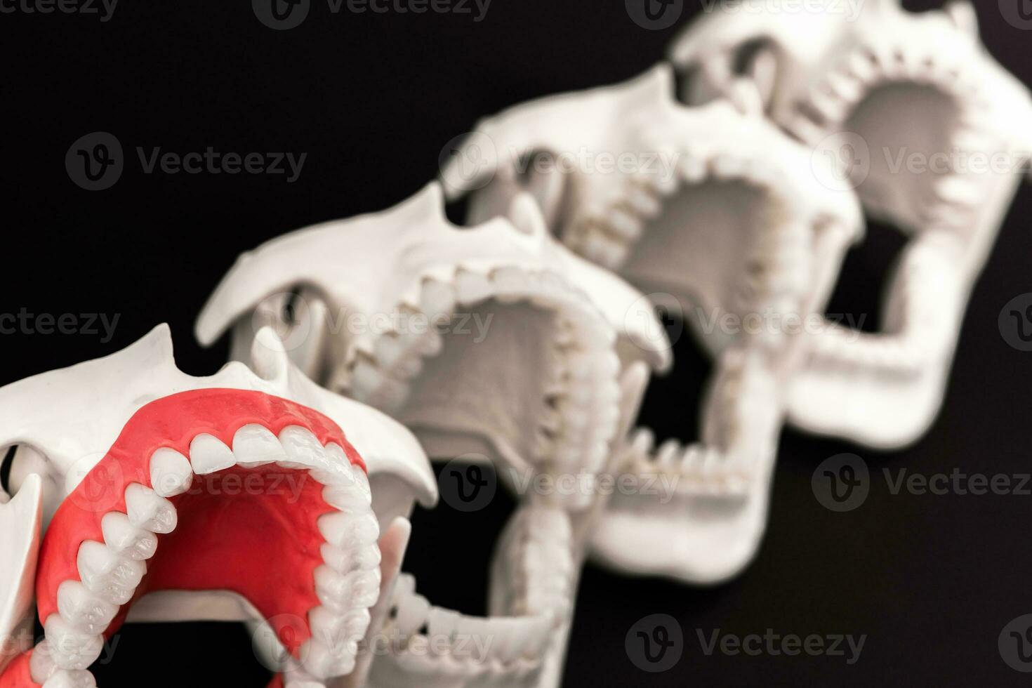 Teeth implant and crown installation process parts isolated on a blue background. Medically accurate 3D model. photo