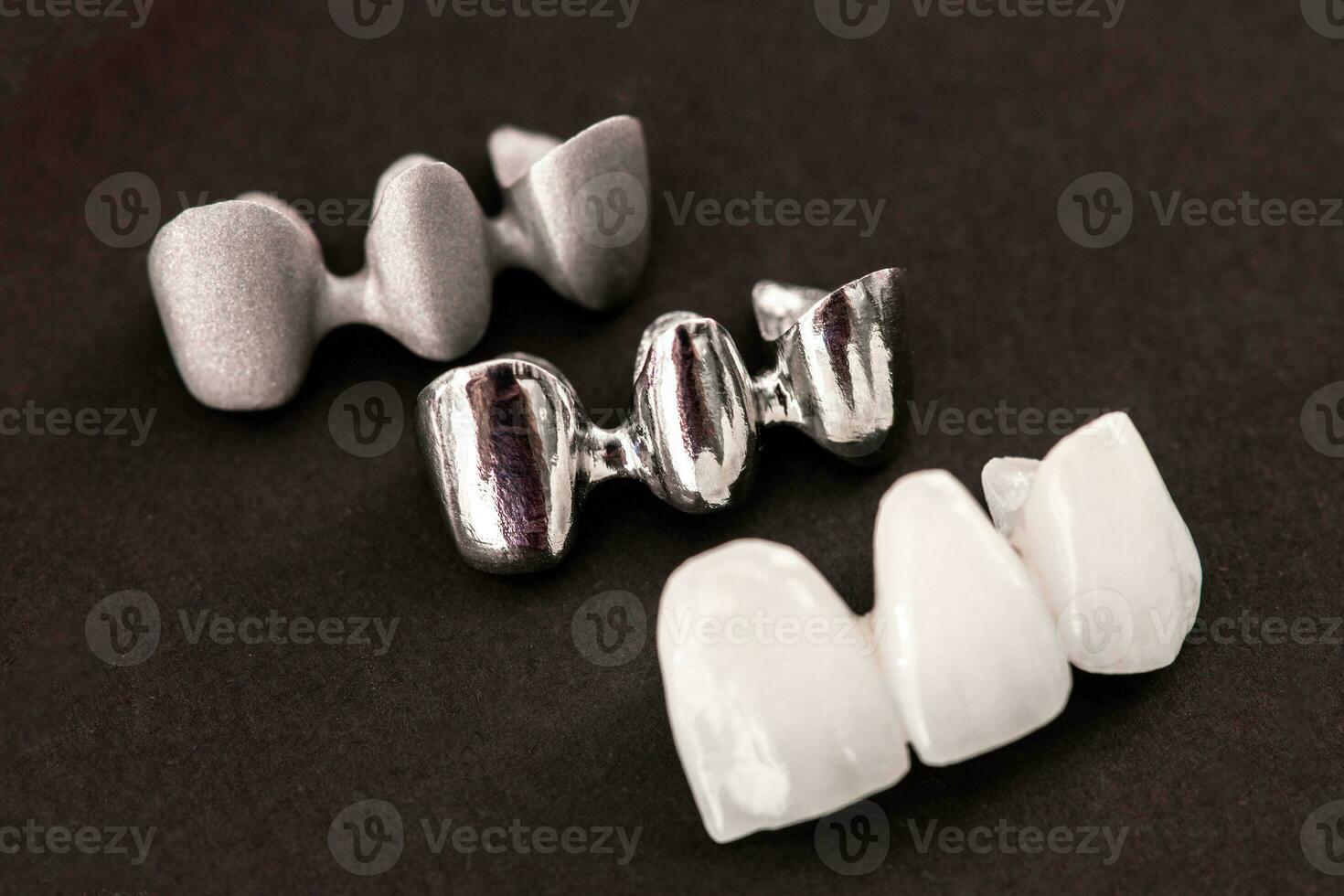 Teeth implant and crown installation process parts isolated on a black background. Medically accurate 3D model. photo