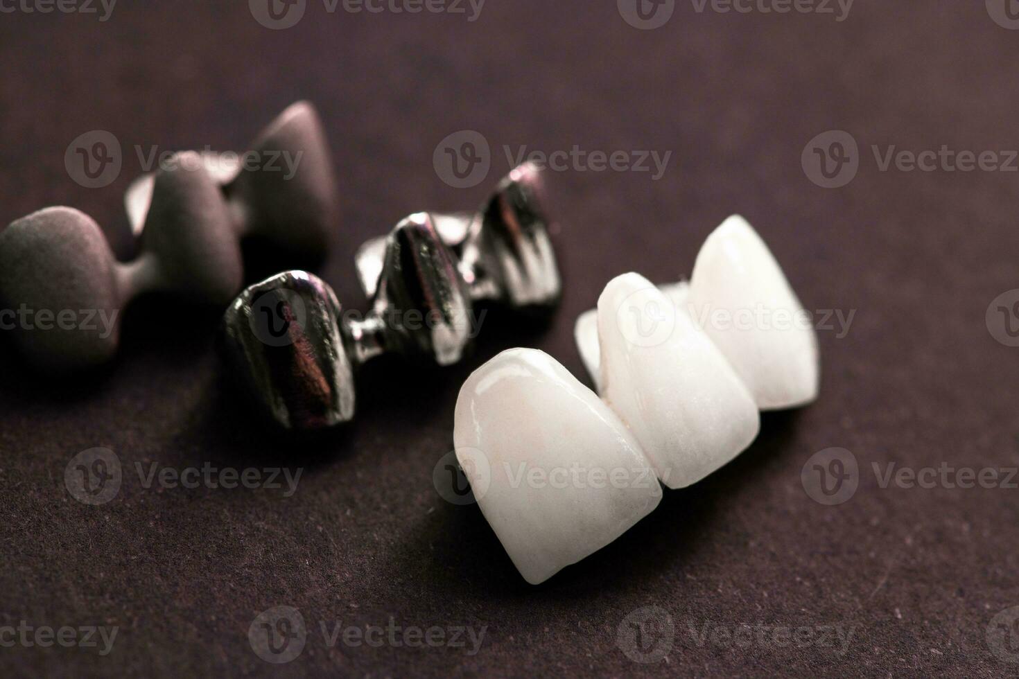 Teeth implant and crown installation process parts isolated on a black background. Medically accurate 3D model. photo