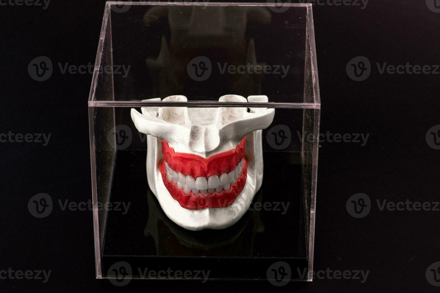 Human jaw with teeth implants anatomy model isolated on black background in a glass box. photo