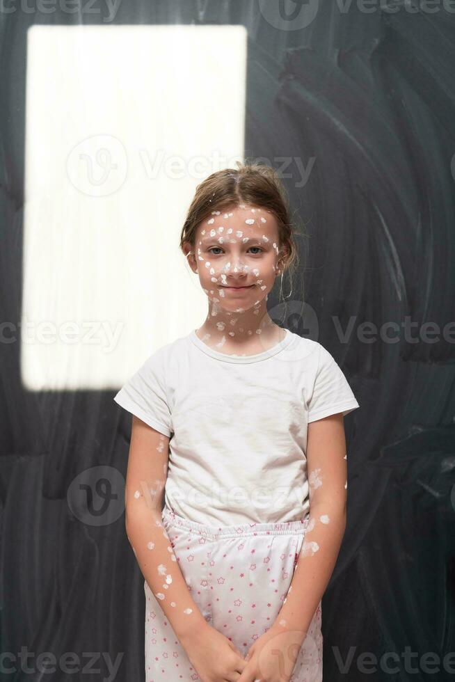 Portrait of a little school girl with chickenpox, antiseptic cream applied to face and body .Colorful background. photo