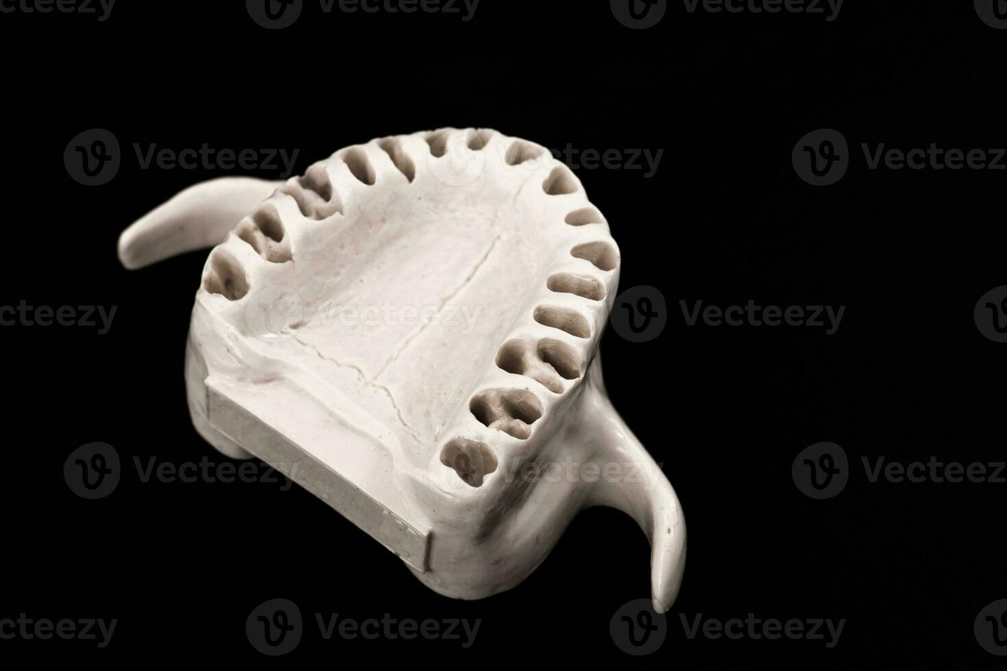 Upper human jaw without teeth model medical implant isolated on black background. Healthy teeth, dental care and orthodontic concept. photo