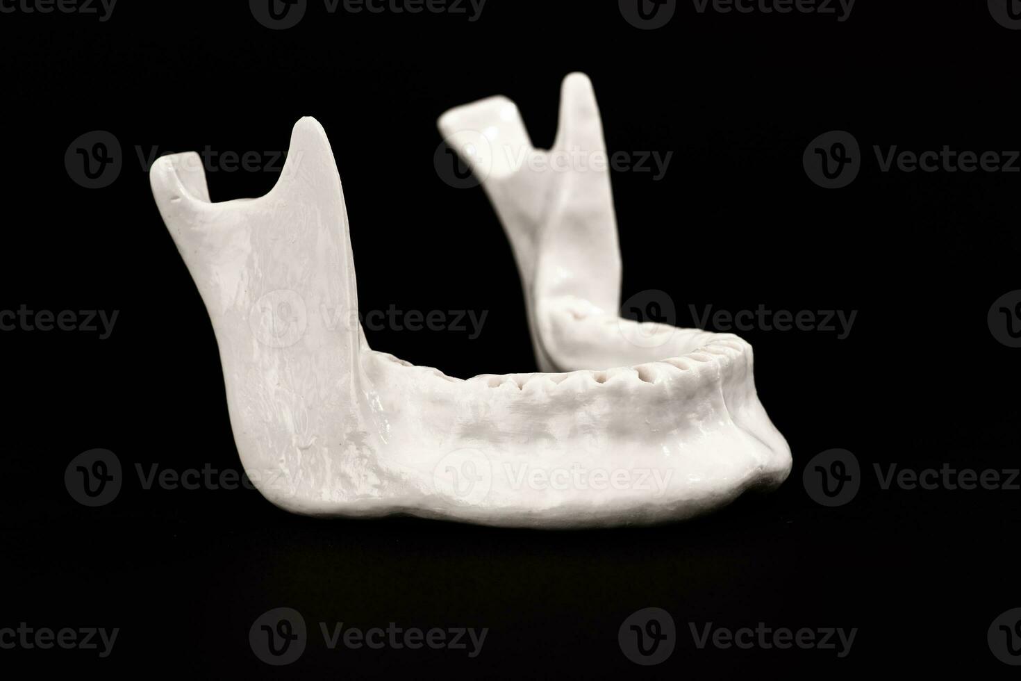 Upper human jaw without teeth model medical implant isolated on black background. Healthy teeth, dental care and orthodontic concept. photo