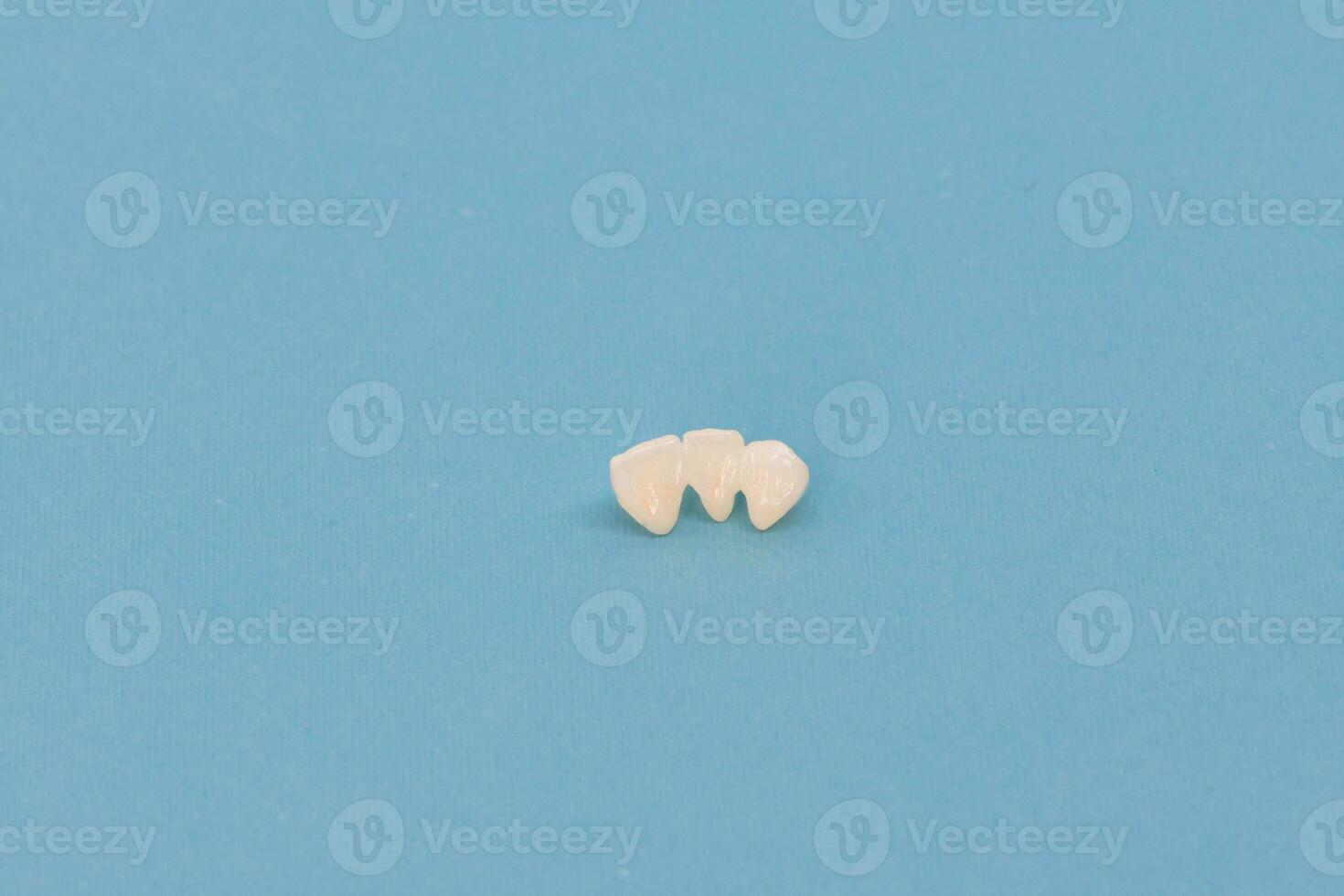 Metal free ceramic teeth implant dental crowns isolated on a blue background. photo