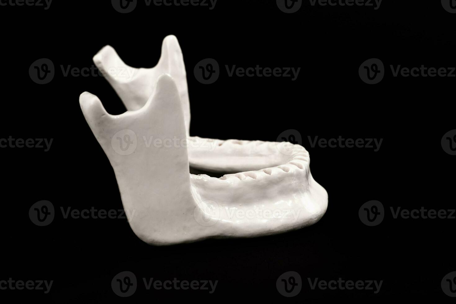 Upper human jaw without teeth model medical implant isolated on black background. Healthy teeth, dental care and orthodontic concept. photo