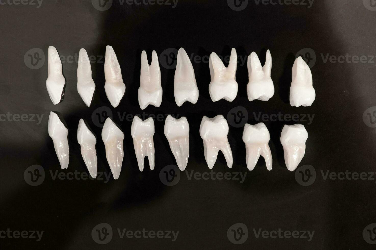 Prosthetic dentistry White teeth on black background Oral dental hygiene Dental health concept Oral care teeth restoration top view. photo