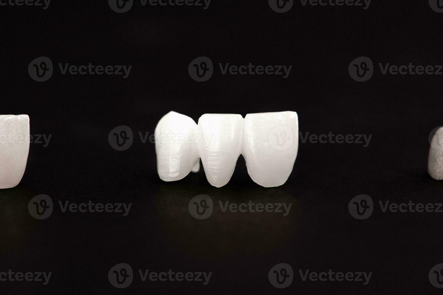 Teeth implant and crown installation process parts isolated on a black background. Medically accurate 3D model. photo