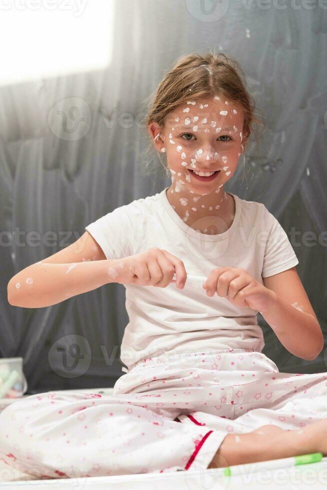 Little school girl with chickenpox drawing on white board in kids' room, antiseptic cream applied to face and body. Chalkboard and toys background. photo