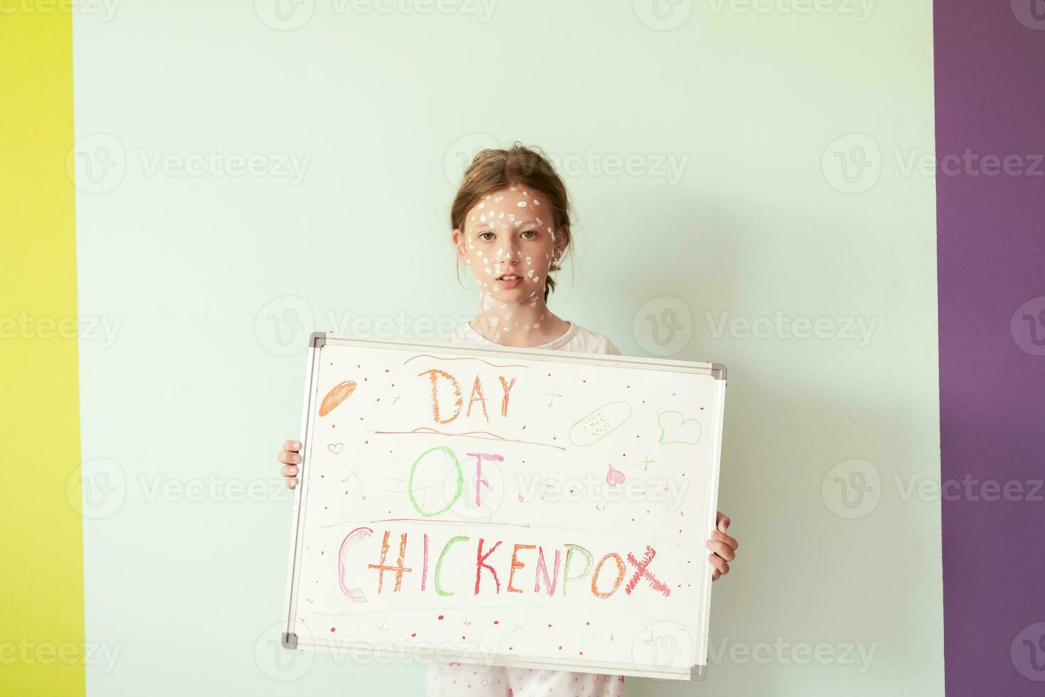A little schoolgirl with chickenpox draws a message on the whiteboard in the kids' room, and antiseptic cream is applied to the face and body. Chalkboard background. photo