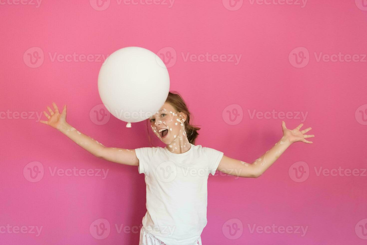 Portrait of a little school girl with chickenpox, antiseptic cream applied to face and body. Playing with a white balloon. Health care and medical concept. Pink background photo