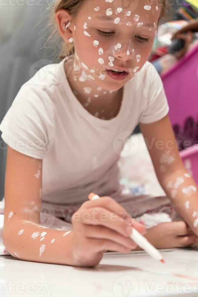 Little school girl with chickenpox drawing on white board in kids' room, antiseptic cream applied to face and body. Chalkboard and toys background. photo