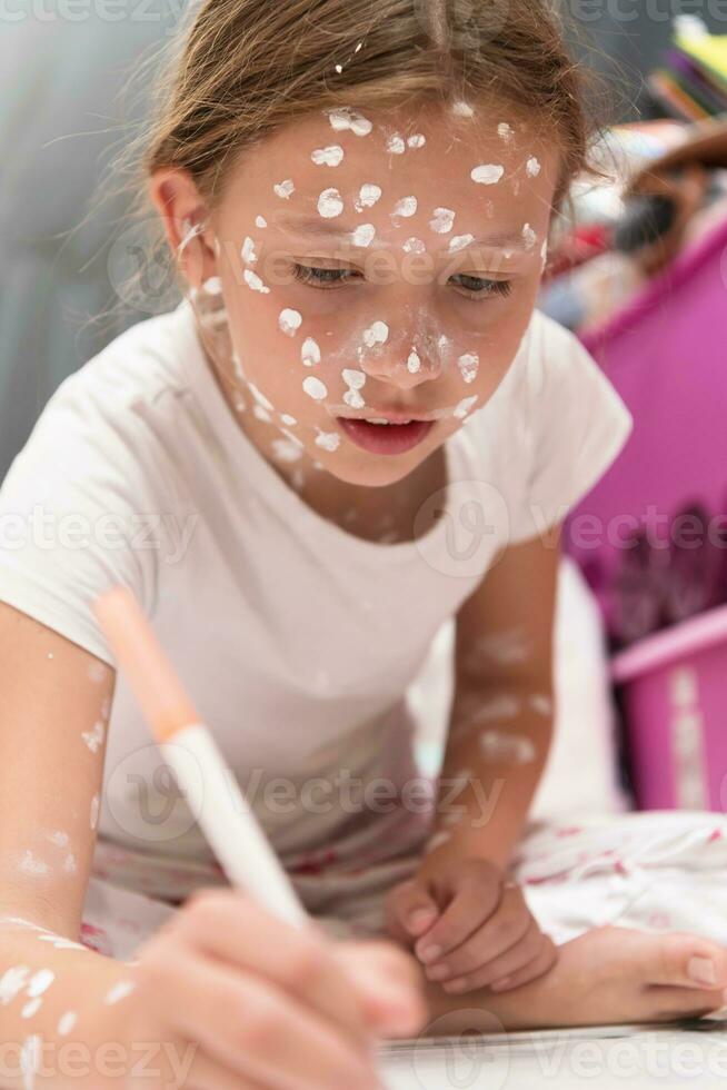 Little school girl with chickenpox drawing on white board in kids' room, antiseptic cream applied to face and body. Chalkboard and toys background. photo