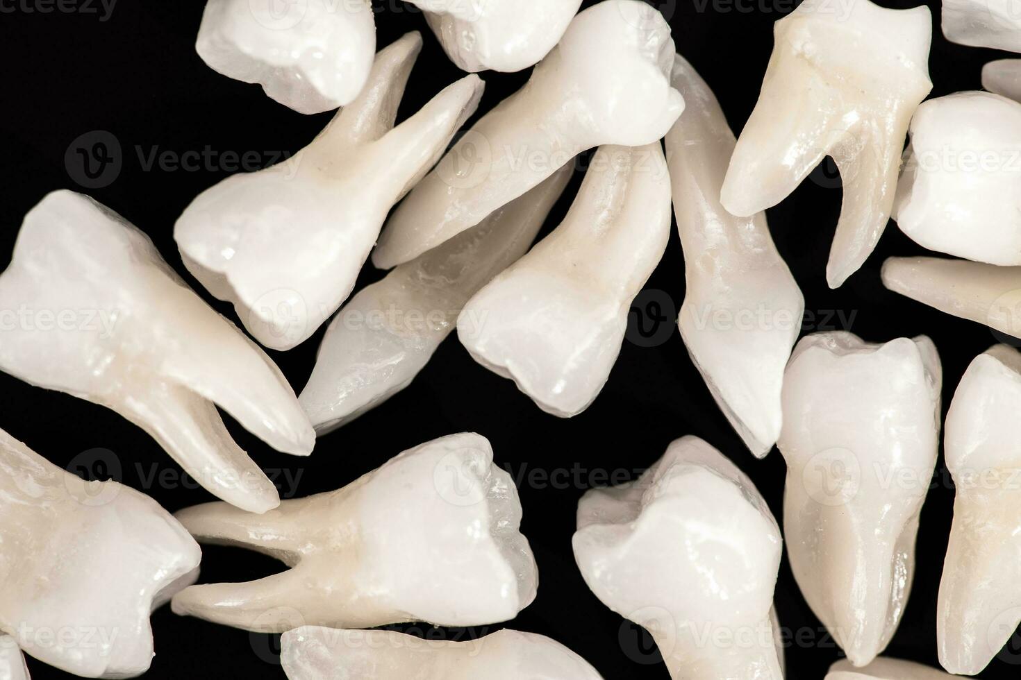 Teeth implant and crown installation process parts isolated on a blue background. Medically accurate 3D model. photo