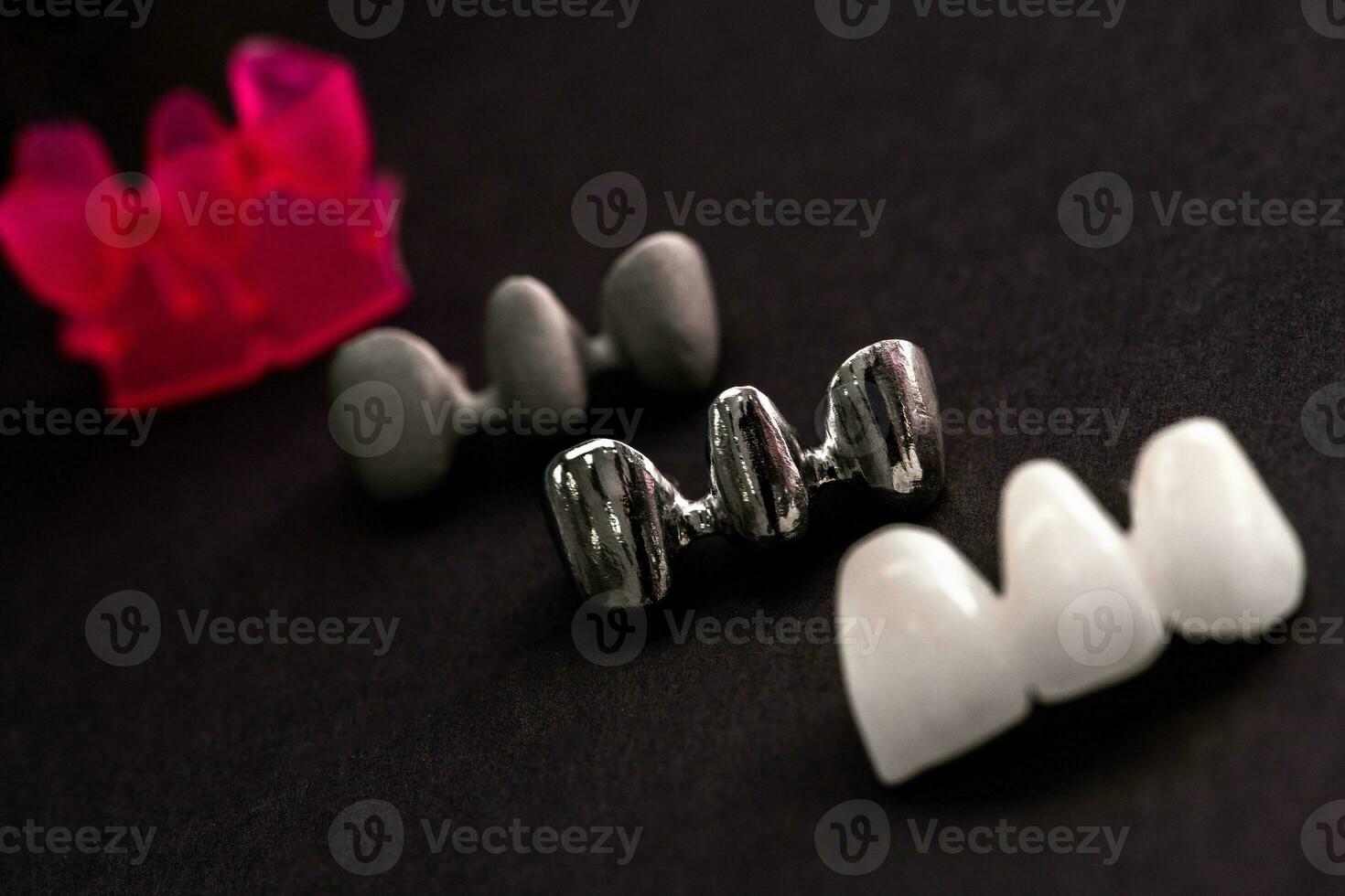 Teeth implant and crown installation process parts isolated on a black background. Medically accurate 3D model. photo