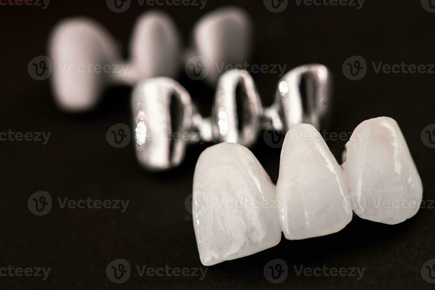 Teeth implant and crown installation process parts isolated on a black background. Medically accurate 3D model. photo
