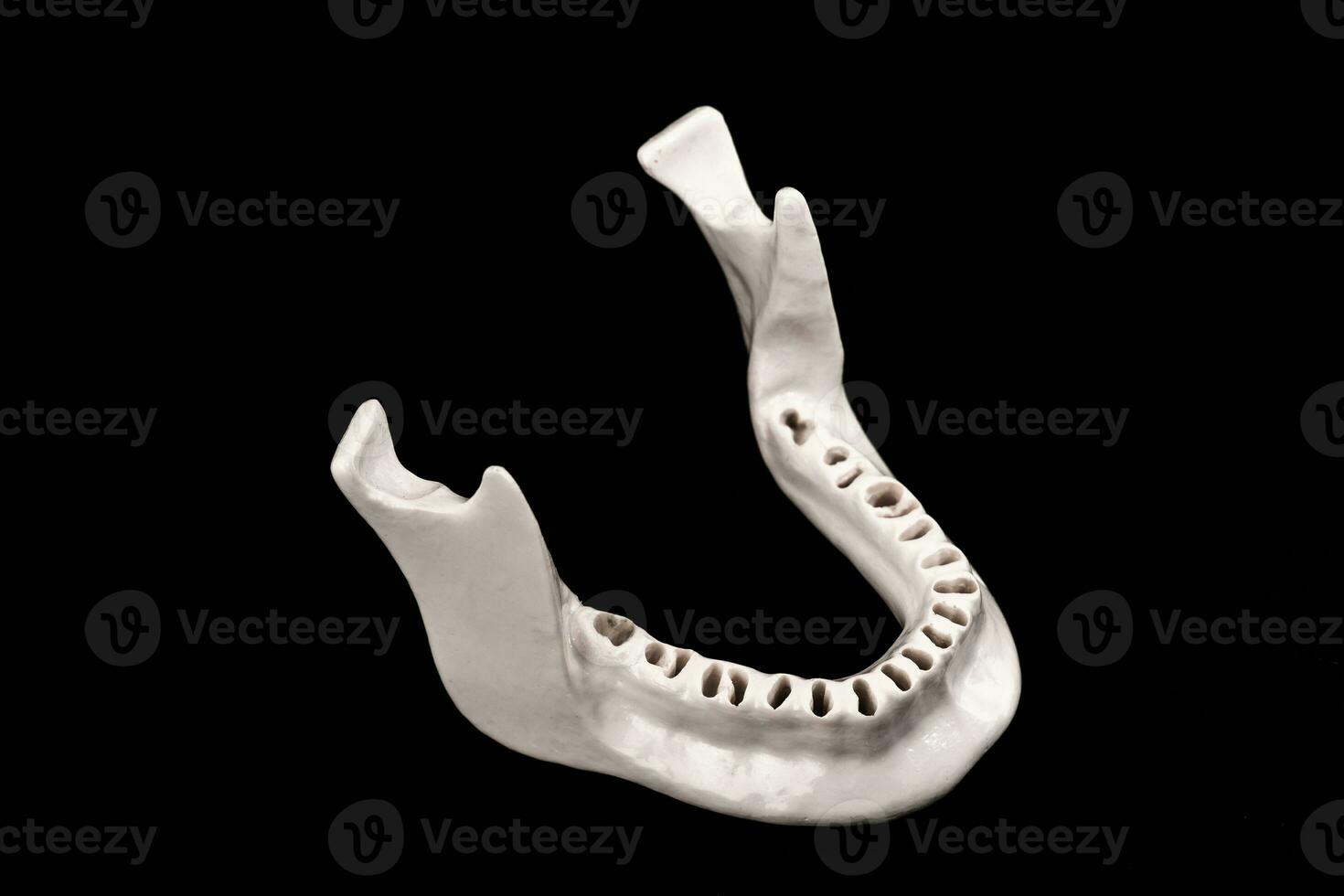 Upper human jaw without teeth model medical implant isolated on black background. Healthy teeth, dental care and orthodontic concept. photo