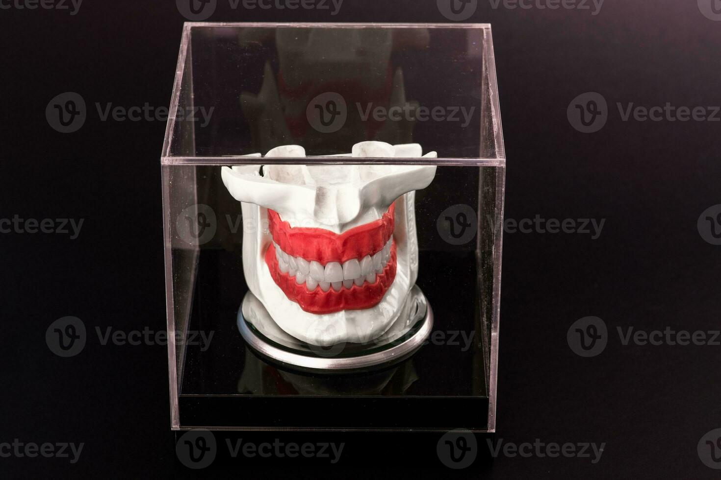 Human jaw with teeth implants anatomy model isolated on black background in a glass box. photo