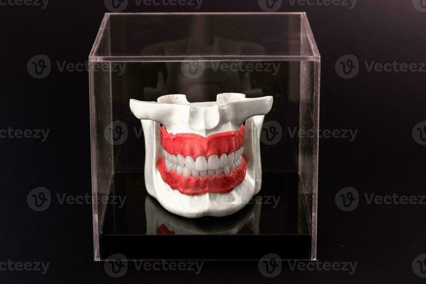 Human jaw with teeth implants anatomy model isolated on black background in a glass box. photo